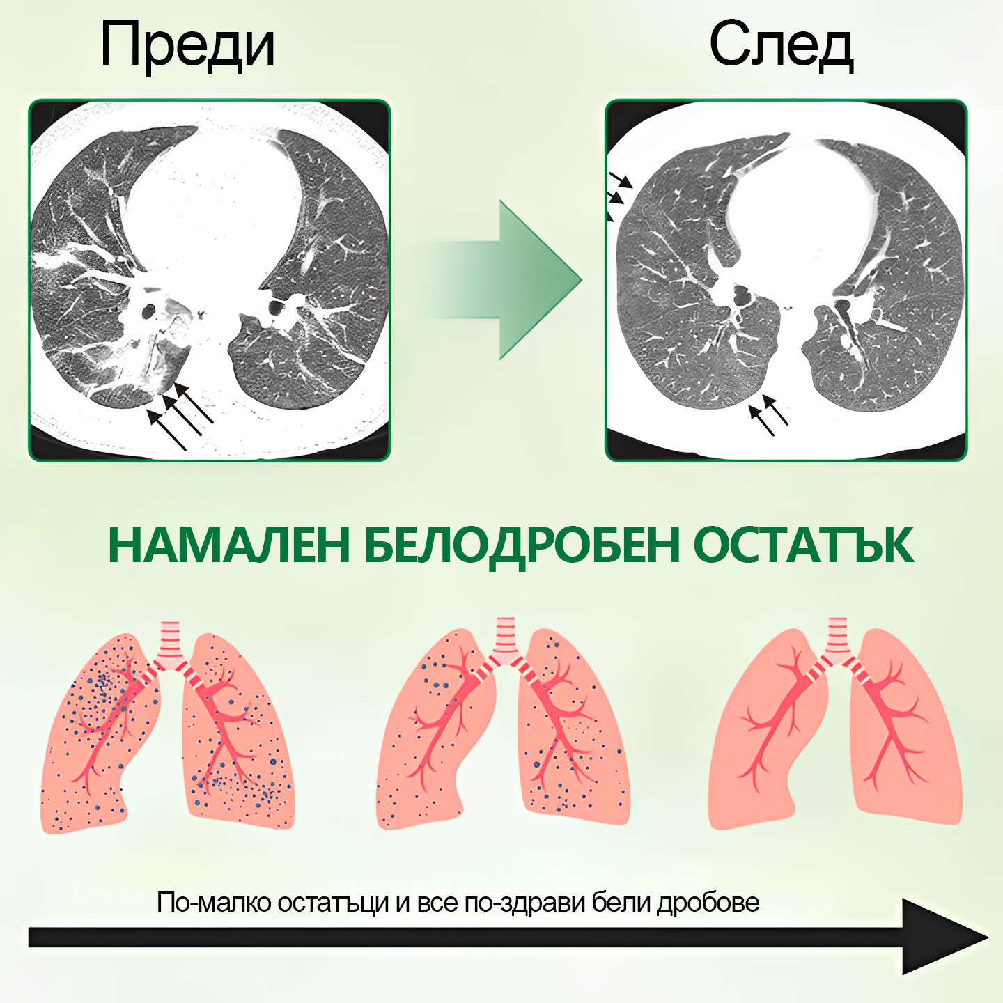 🍀🍀𝐆𝐨𝐨𝐲𝐞𝐞𝐫™ Висококачествен спрей за бели дробове -🧑⚕️ Подпомага здравето на белите дробове, бронхите и синусите, подкрепя дихателната система и улеснява по-лекото дишане.