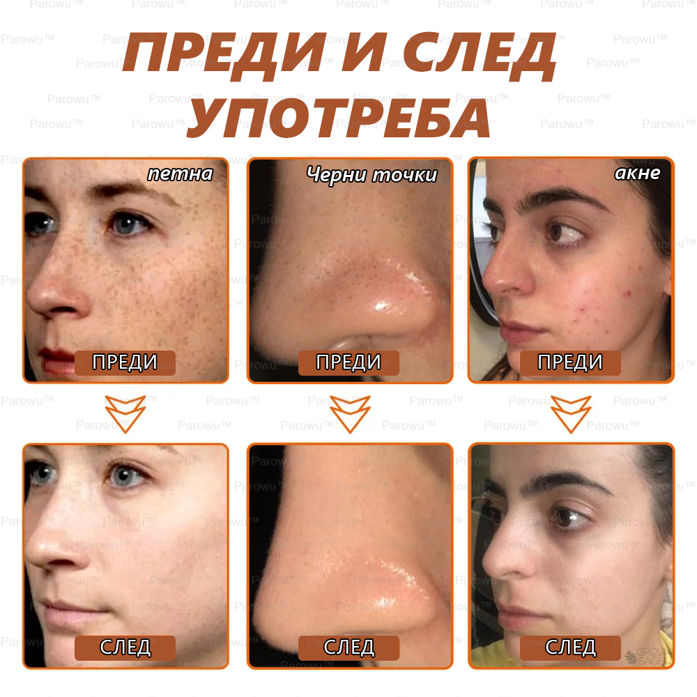 💟Parowu™ Изсветляваща и премахваща петна маска - 🍃Натурални съставки за дълготрайно премахване на петна, хиперпигментации и слънчеви петна