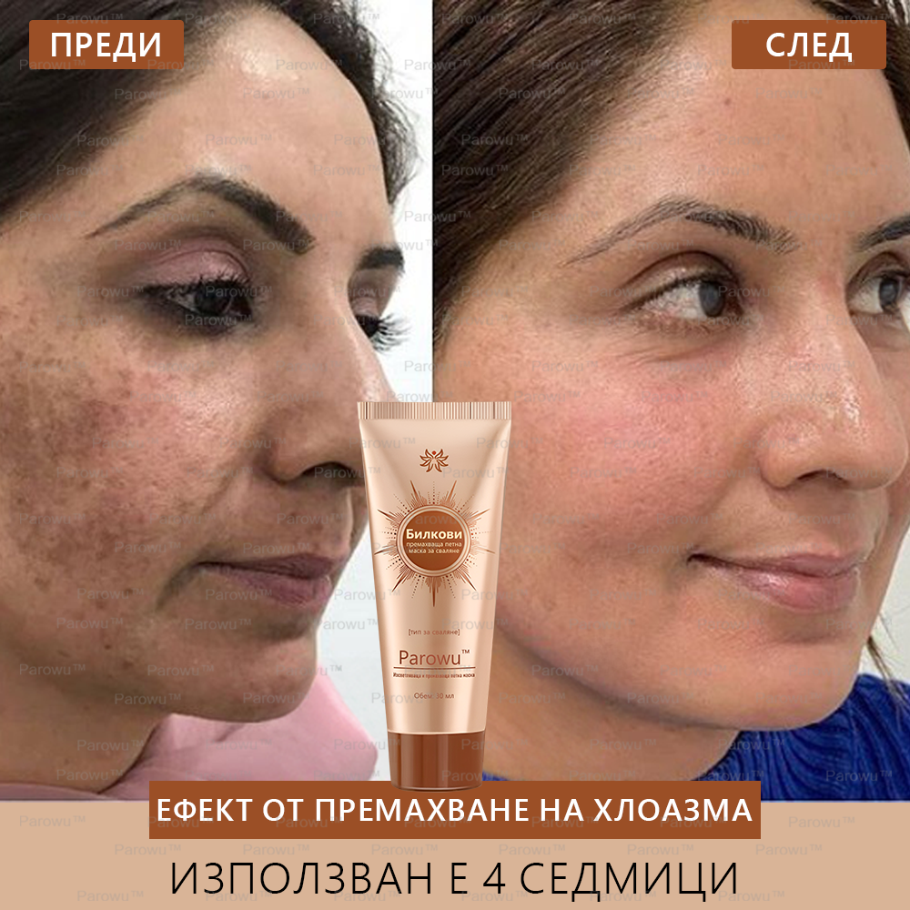 💟Parowu™ Изсветляваща и премахваща петна маска - 🍃Натурални съставки за дълготрайно премахване на петна, хиперпигментации и слънчеви петна