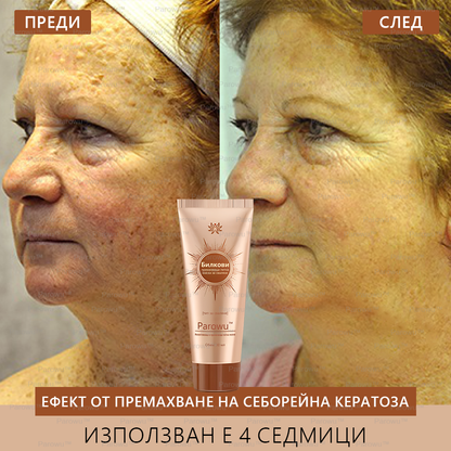 💟Parowu™ Изсветляваща и премахваща петна маска - 🍃Натурални съставки за дълготрайно премахване на петна, хиперпигментации и слънчеви петна