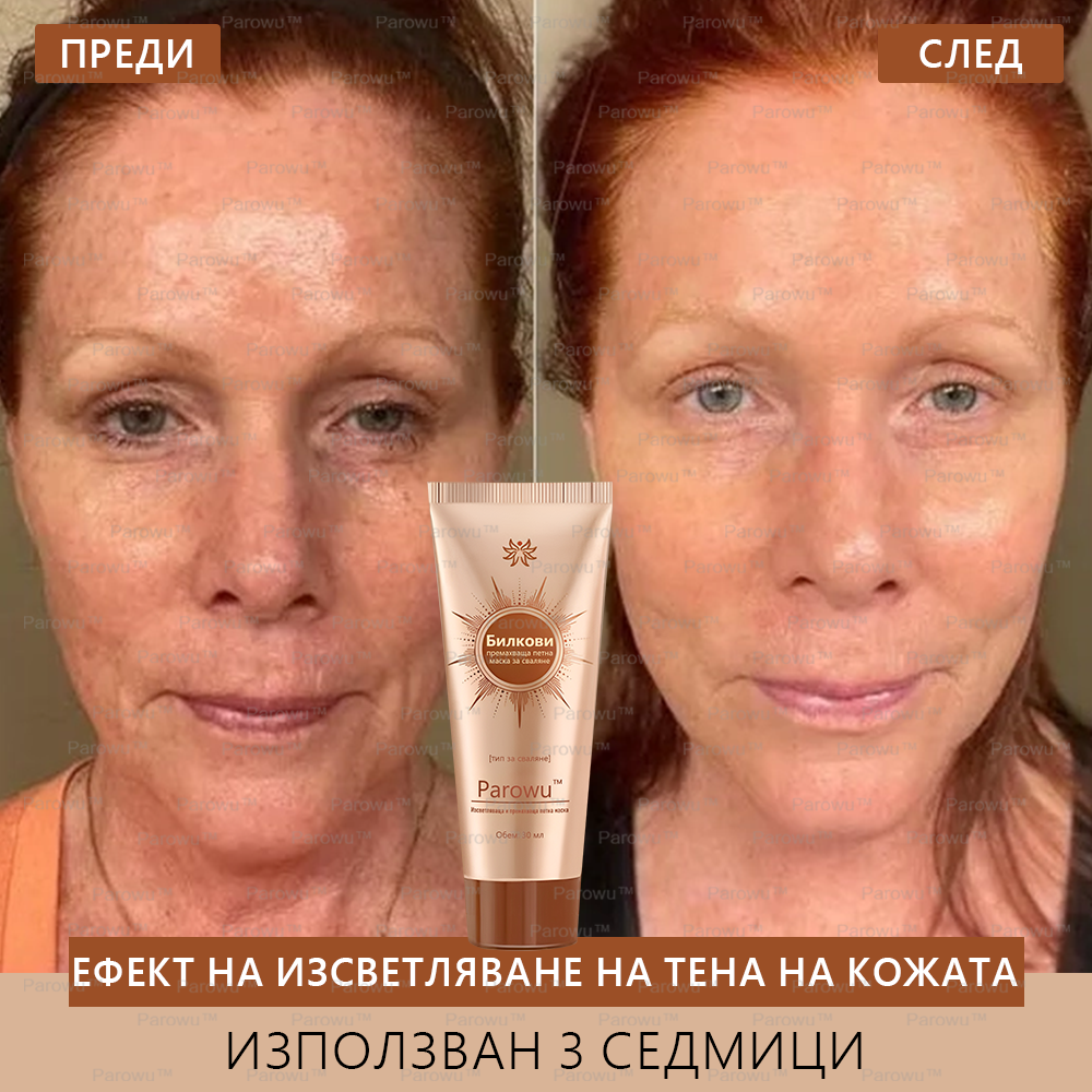 💟Parowu™ Изсветляваща и премахваща петна маска - 🍃Натурални съставки за дълготрайно премахване на петна, хиперпигментации и слънчеви петна