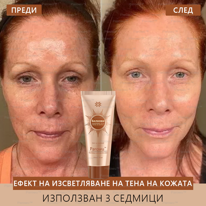 💟Parowu™ Изсветляваща и премахваща петна маска - 🍃Натурални съставки за дълготрайно премахване на петна, хиперпигментации и слънчеви петна