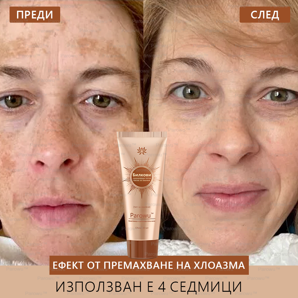 💟Parowu™ Изсветляваща и премахваща петна маска - 🍃Натурални съставки за дълготрайно премахване на петна, хиперпигментации и слънчеви петна