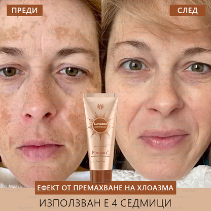 💟Parowu™ Изсветляваща и премахваща петна маска - 🍃Натурални съставки за дълготрайно премахване на петна, хиперпигментации и слънчеви петна